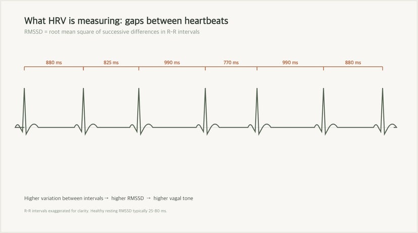 ECG waveform showing changing time intervals between consecutive heartbeats